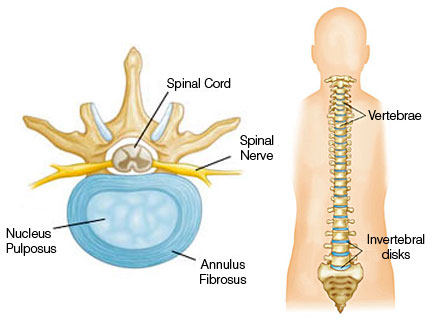 Symptoms of Degenerative Disc Disease