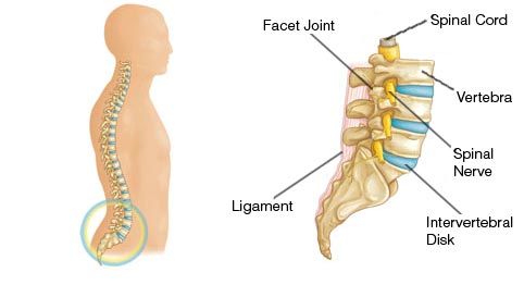 Image of Spinal Stenosis
